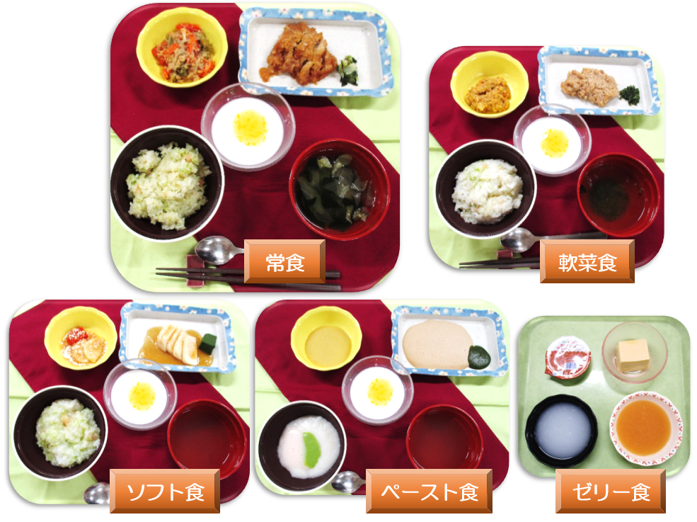 「西武川越病院」の食形態の種類